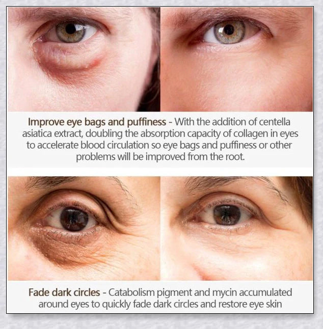 Magic Eye Cream that instantly reduces bags, dark circles, and wrinkles in just 28 seconds for youthful, radiant under-eye skin