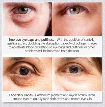 Magic Eye Cream that instantly reduces bags, dark circles, and wrinkles in just 28 seconds for youthful, radiant under-eye skin