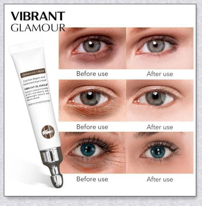 Magic Eye Cream that instantly reduces bags, dark circles, and wrinkles in just 28 seconds for youthful, radiant under-eye skin