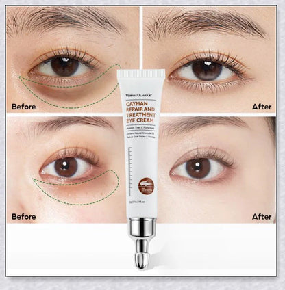 Magic Eye Cream that instantly reduces bags, dark circles, and wrinkles in just 28 seconds for youthful, radiant under-eye skin
