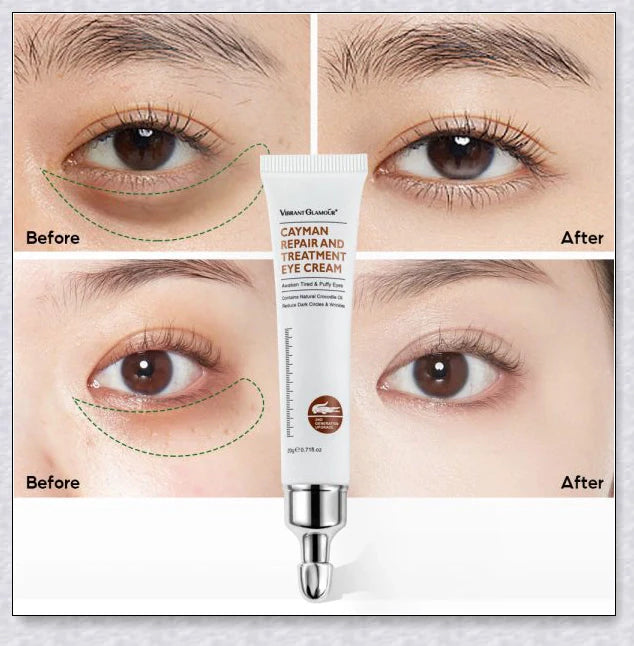 Hhomeenjoy Magic Eye Cream - 28 Seconds to Remove Bags, Dark Circles, and Eye Wrinkles