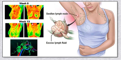 A stylish magnetic bracelet designed to stimulate lymphatic drainage and improve overall circulation for better health and wellness.