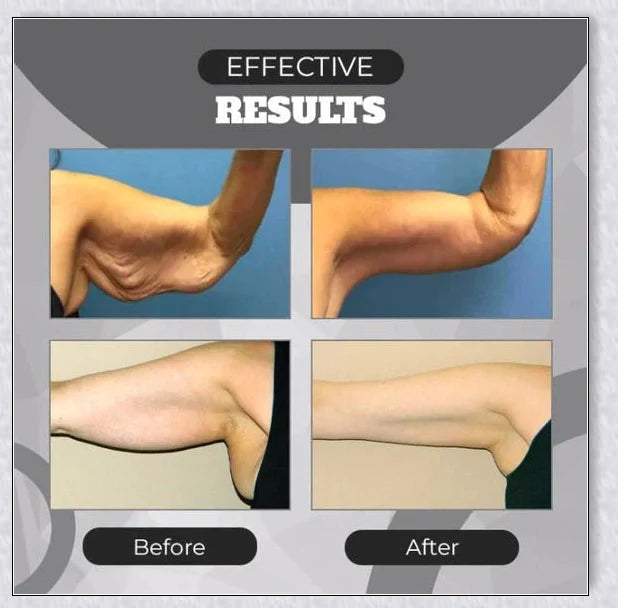 A stylish magnetic bracelet designed to stimulate lymphatic drainage and improve overall circulation for better health and wellness.