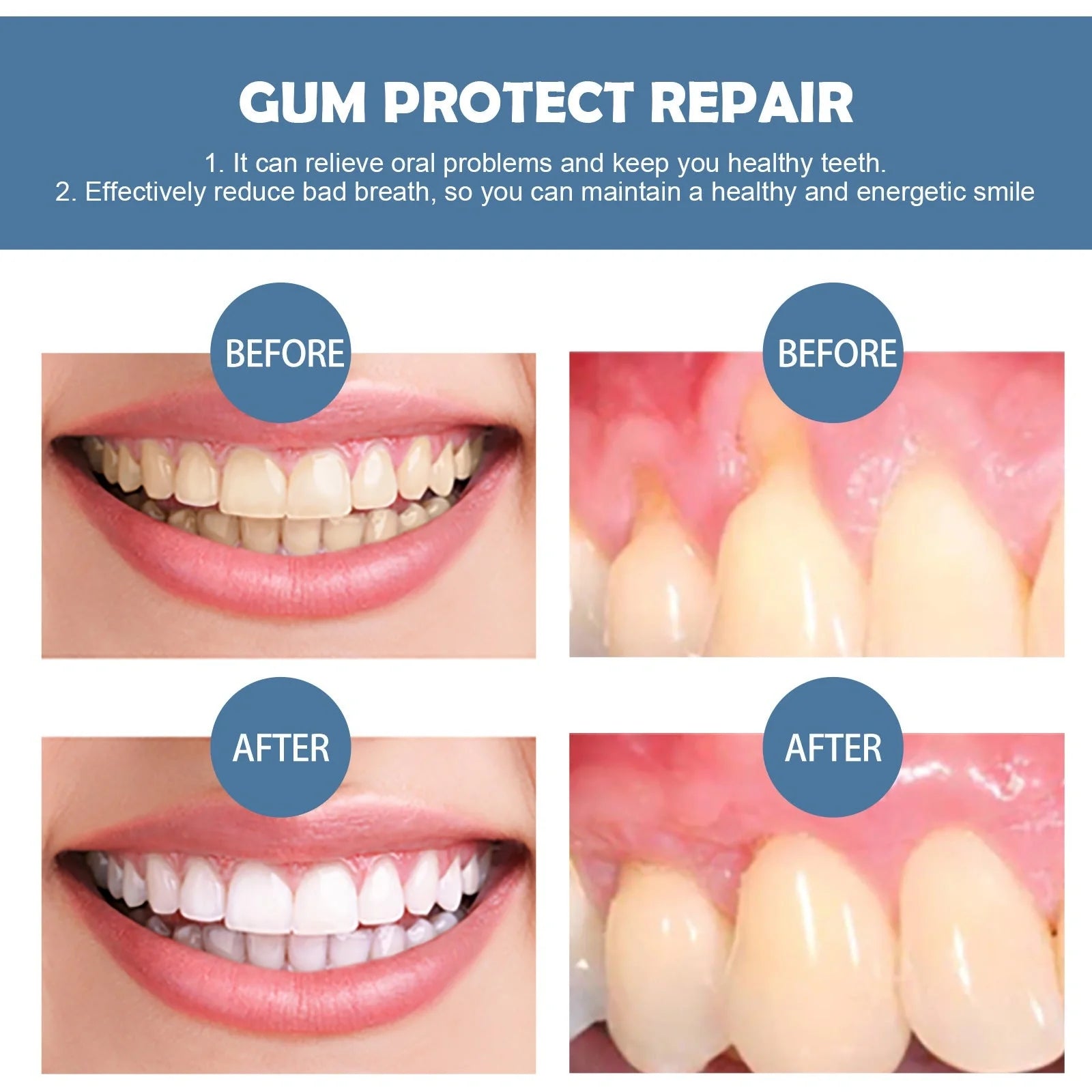 Gum Repair Series products including drops, essence, and spray for rejuvenating oral health and removing tooth stains