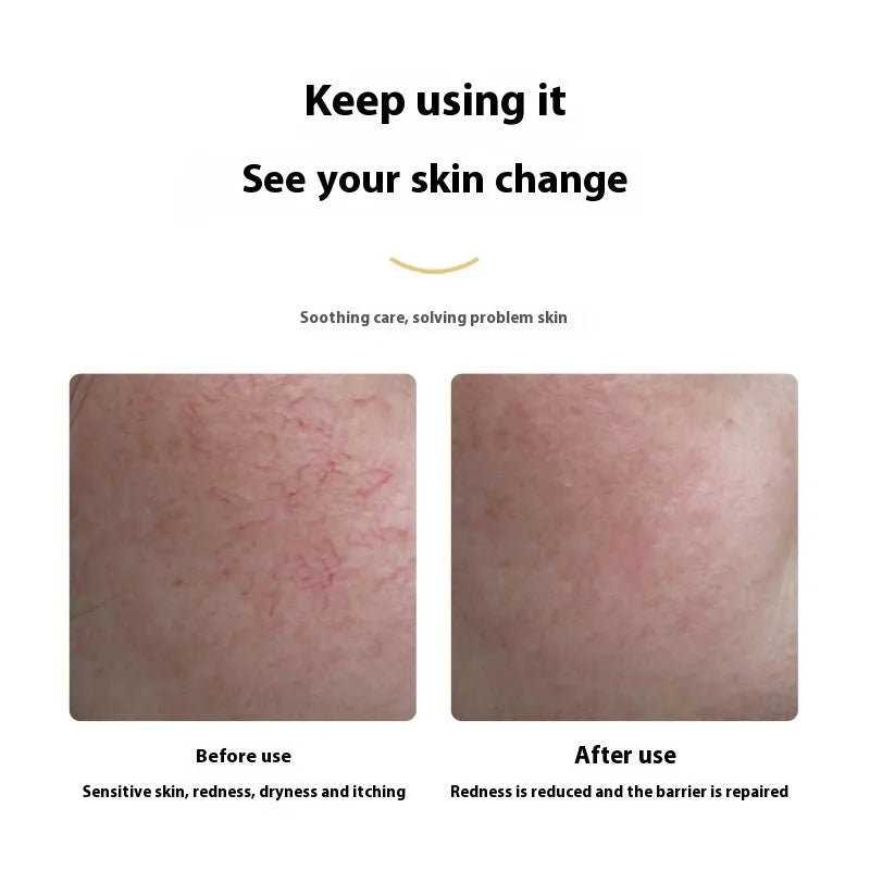 40ml repairing lotion for dry and sensitive skin in an emulsion gel format for ladies daily face care