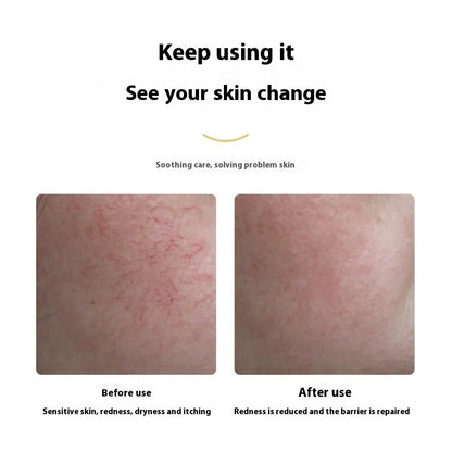 40ml repairing lotion for dry and sensitive skin in an emulsion gel format for ladies daily face care