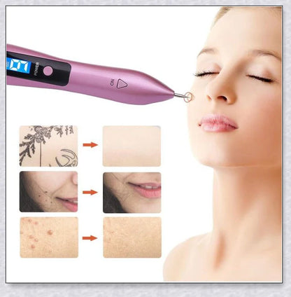 Skin Tag And Mole Remover - Innovative nano-needle technology for safe and effective removal of skin tags, moles, freckles, and other blemishes