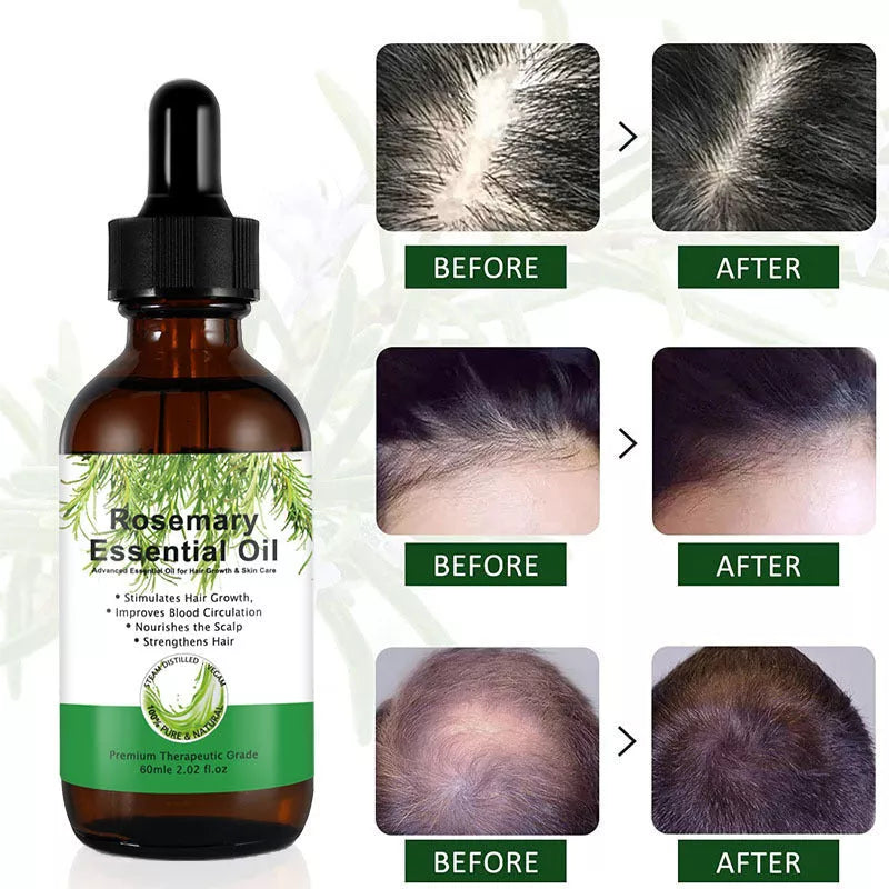 Rosemary Hair Growth Serum bottle with 60ml net content for damaged hair repair