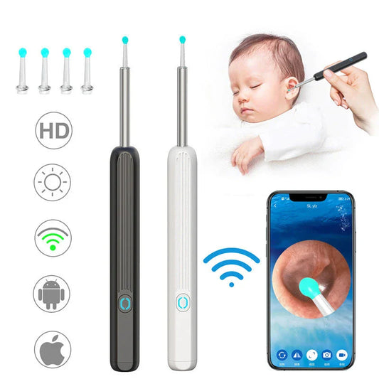 Wireless otoscope with 360-degree HD camera and LED light for safe and effective earwax removal