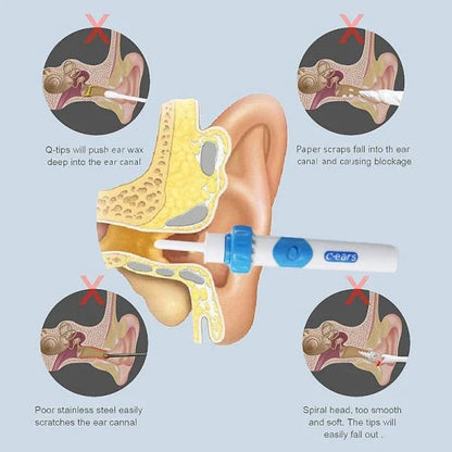 Ear Wax Vacuum Cleaner Removal Kit, featuring a suction tool with soft silicone tips for safe and effective earwax removal