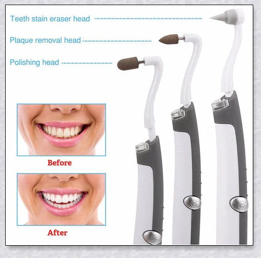 A white sonic tooth stain eraser and plaque remover with 3 different cleaning heads for removing stains and massaging gums.
