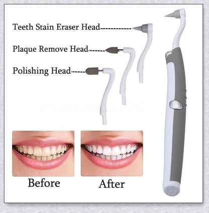 A white sonic tooth stain eraser and plaque remover with 3 different cleaning heads for removing stains and massaging gums.