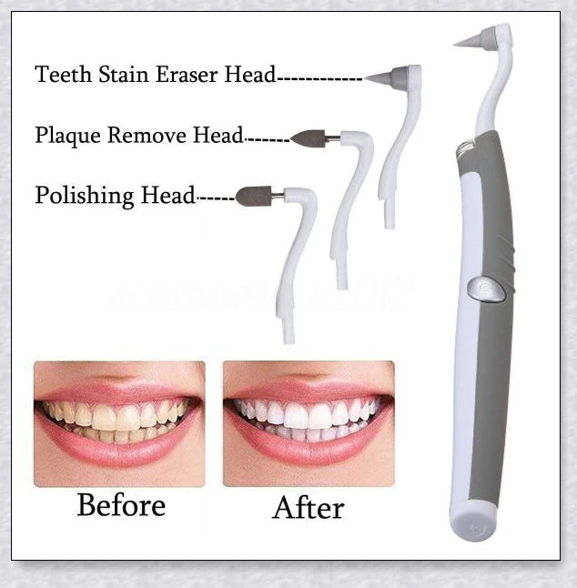 Hhomeenjoy Sonic Tooth Stain Eraser and Plaque Remover
