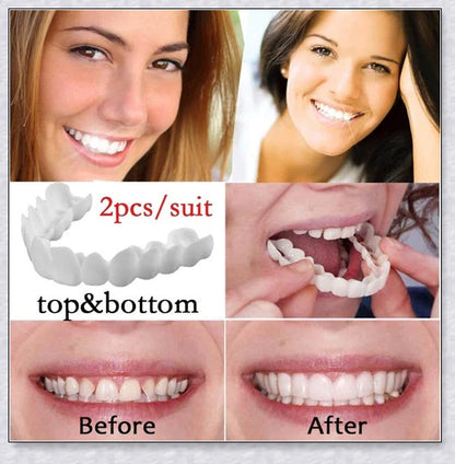 Snap-On Veneers that instantly transform your smile by disguising crooked, stained, or missing teeth