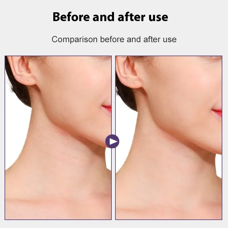 Skin tone neck firming adhesive tape with four straps and twenty patches in packaging