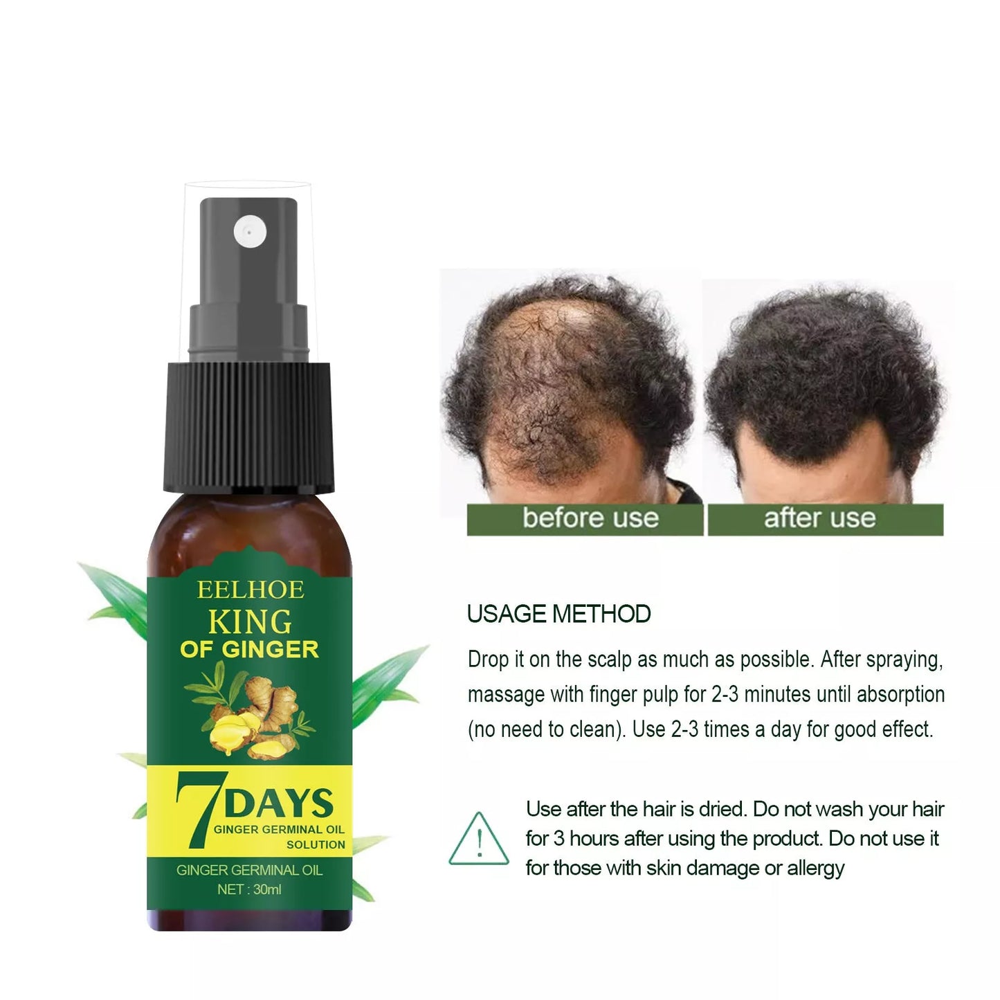 EELHOE Ginger Nutrition Spray for hair root care and moisturizing