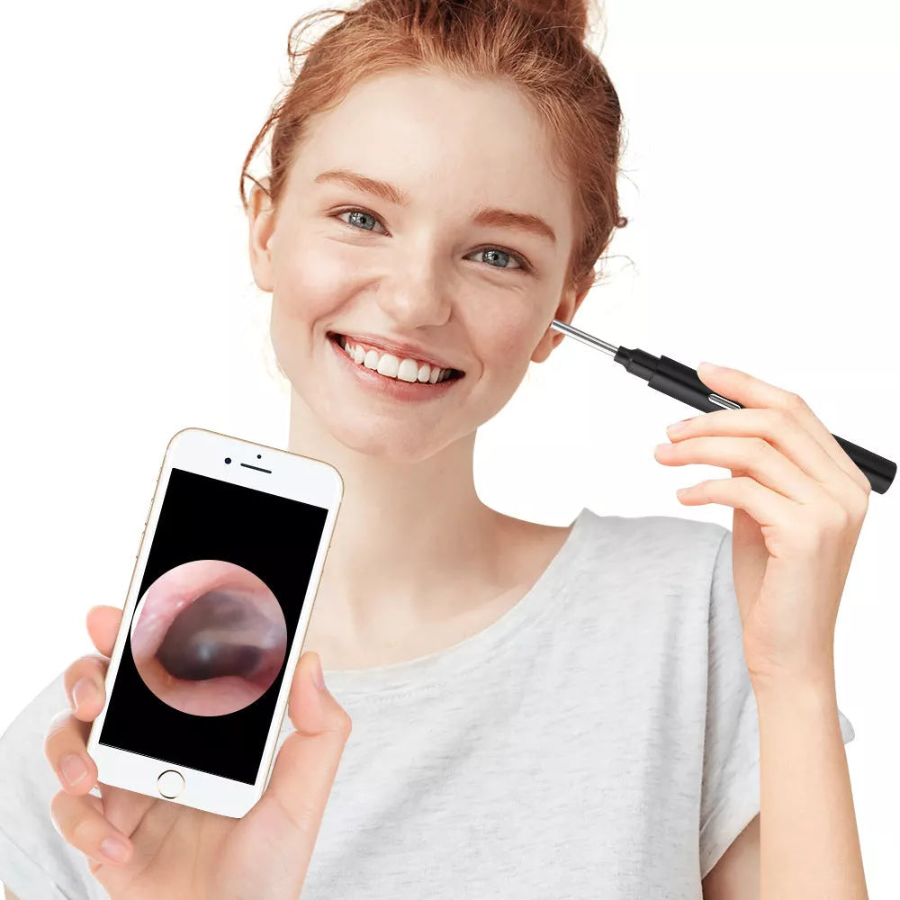 3.9mm Wireless WIFI Visual Otoscope for earwax cleaning with 3-million-pixel camera