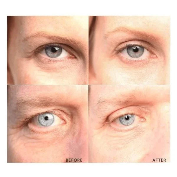 Anti-Aging Eyelid Tape with 120 pairs of transparent, hypoallergenic strips for an instant eye lift
