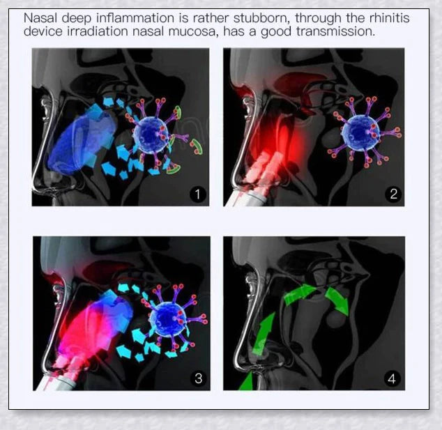 Infrared Rhinitis Therapy Device - an innovative medical device for natural allergy relief