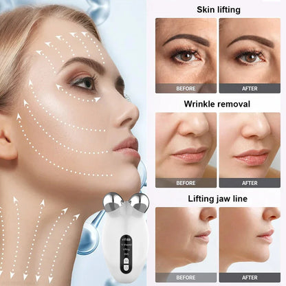 Professional Facial Microcurrent Roller for Lifting and Reducing Double Chin