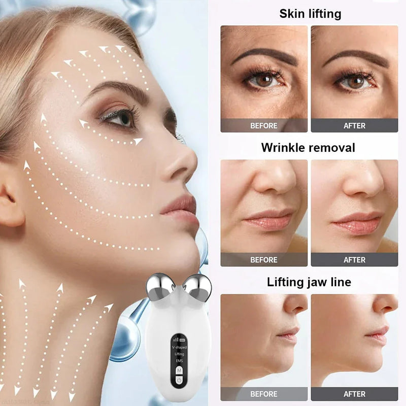 Hhomeenjoy Professional Facial Microcurrent Roller for Lifting & Double Chin Reduction