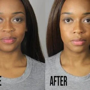 Electric Nose Lifter Device - Non-Surgical Nose Reshaping Tool for Bulbous, Crooked, or Flat Noses