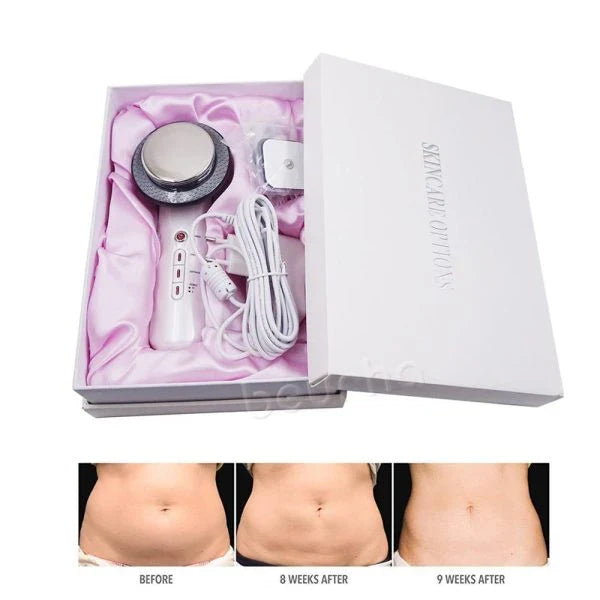 Ultrasonic Cavitation Fat Burner Device for Body Slimming and Anti-Cellulite Treatment