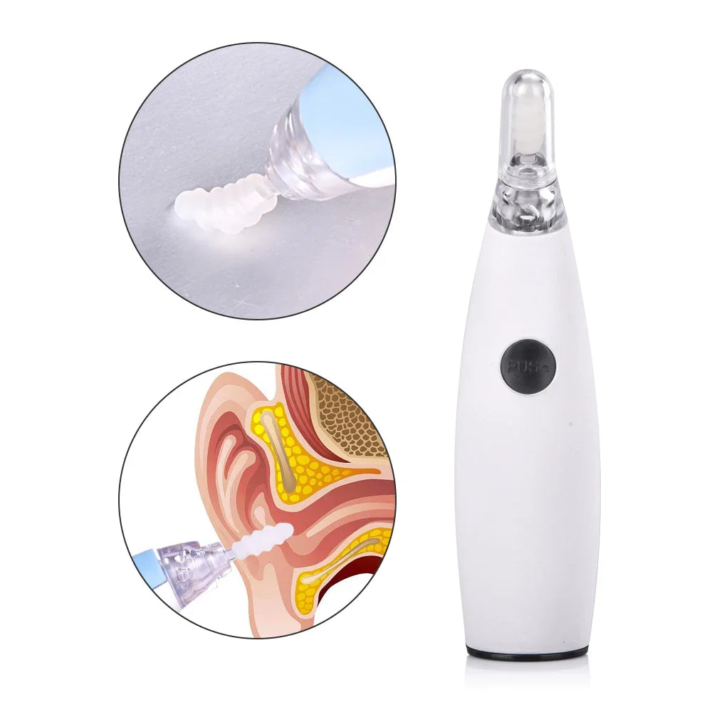 Portable Electric Ear Wax Remover with 360-degree spiral-shaped silicone tip and LED light for safe, effective ear cleaning