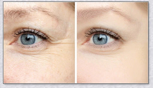Perfection Wrinkles Essence - Advanced anti-aging serum that minimizes wrinkles and restores skin elasticity