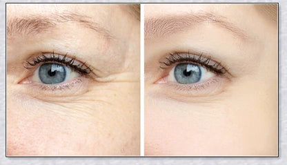Perfection Wrinkles Essence - Advanced anti-aging serum that minimizes wrinkles and restores skin elasticity