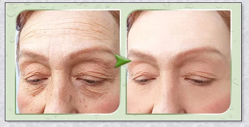 Perfection Wrinkles Essence - Advanced anti-aging serum that minimizes wrinkles and restores skin elasticity