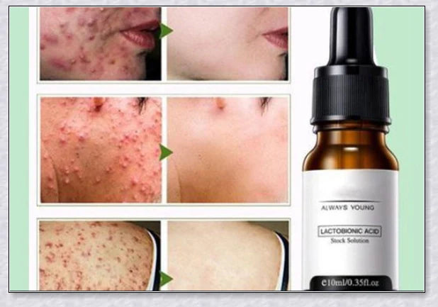 Perfection Wrinkles Essence - Advanced anti-aging serum that minimizes wrinkles and restores skin elasticity