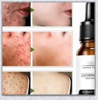 Perfection Wrinkles Essence - Advanced anti-aging serum that minimizes wrinkles and restores skin elasticity