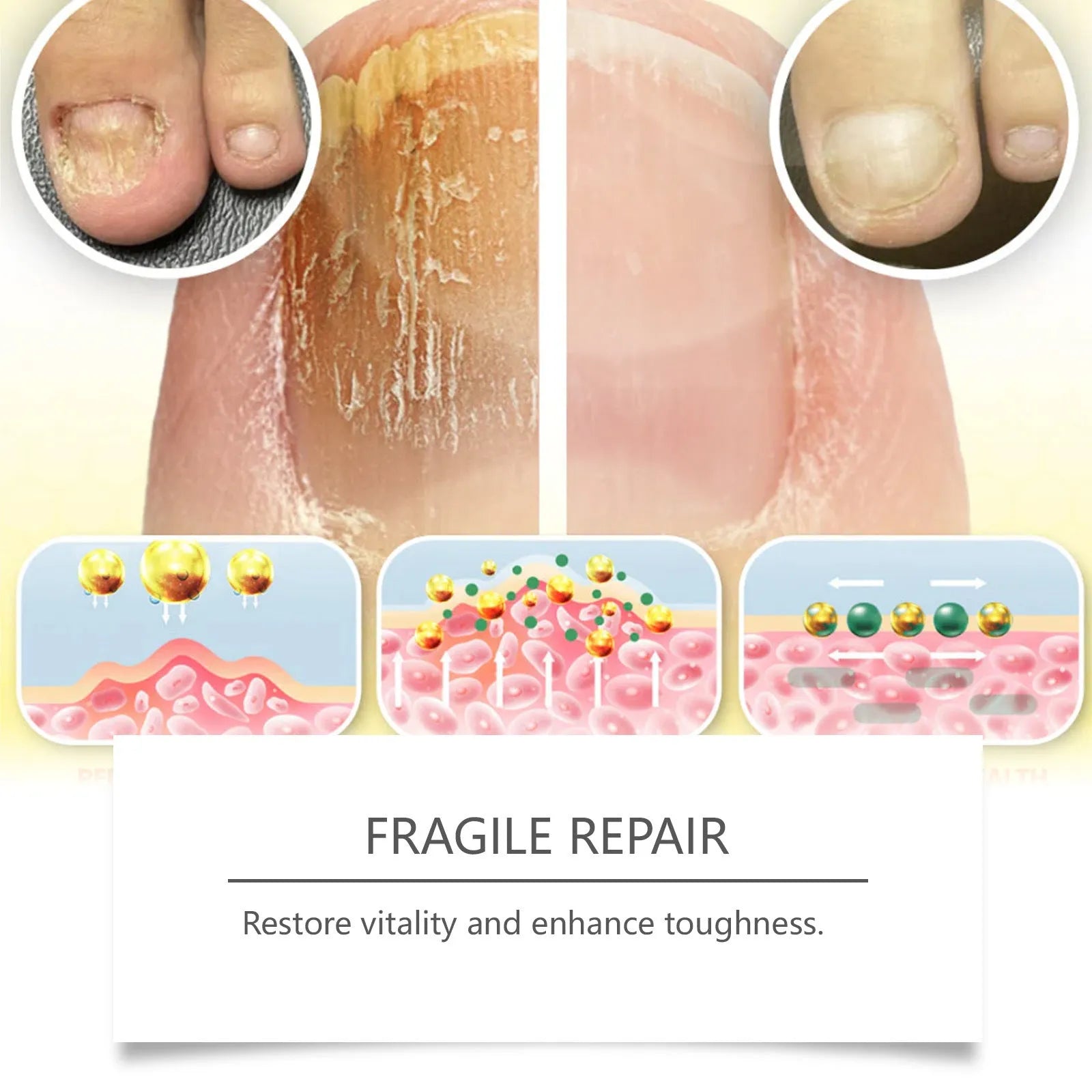 50ml bottle of nail fungus care solution containing bee venom and peppermint oil