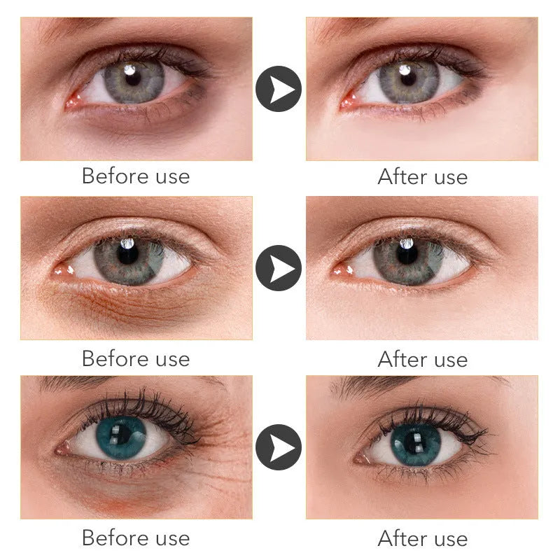 Beauty Eye Cream 30ml bottle for women's under-eye skin care