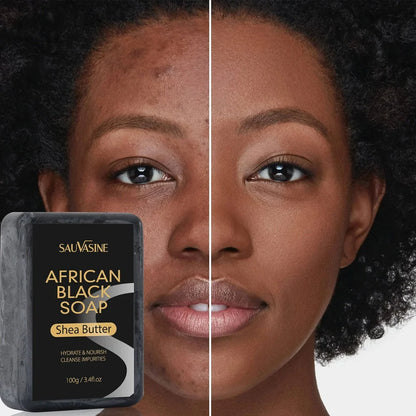 100g African Black Soap bar with deep cleansing and anti-mite properties
