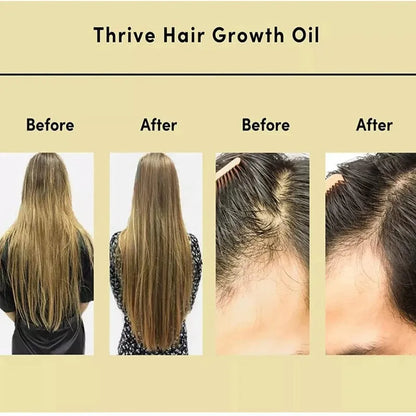 Yellow 60ml bottle of Rosemary Soft Hair Care Essential Oil.
