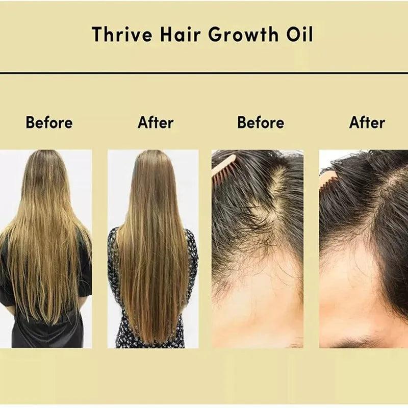Rosemary hair oil for hair care and scalp treatment, soft essential oil formula with 60ml net content, designed to smooth hair, relieve head itch, and care for coloured or permed hair in a yellow-coloured liquid.