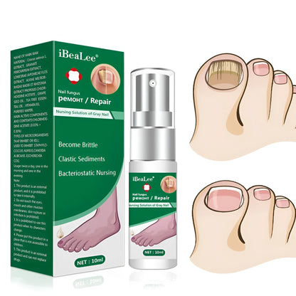 10ml bottle of Jiagou Whitening Antibacterial Liquid foot treatment