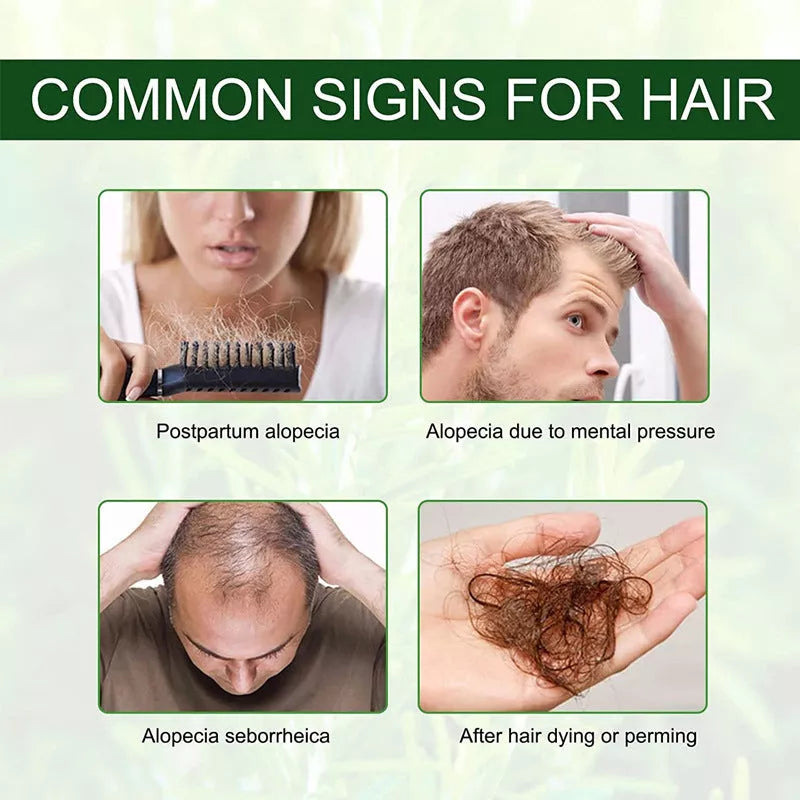 Rosemary Hair Growth Serum bottle with 60ml net content for damaged hair repair