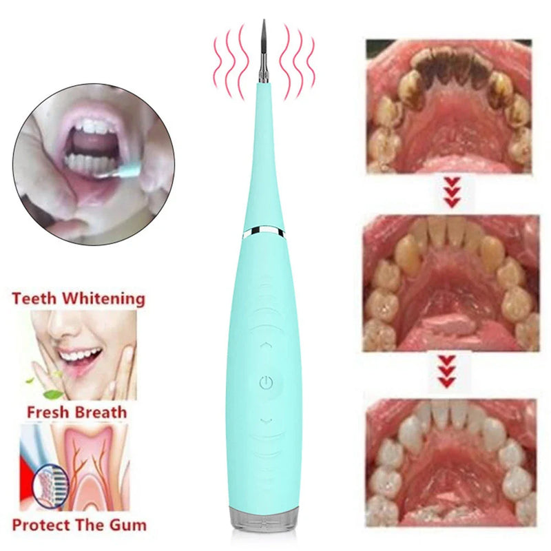 Rechargeable Waterproof Electric Dental Cleaner Tool
