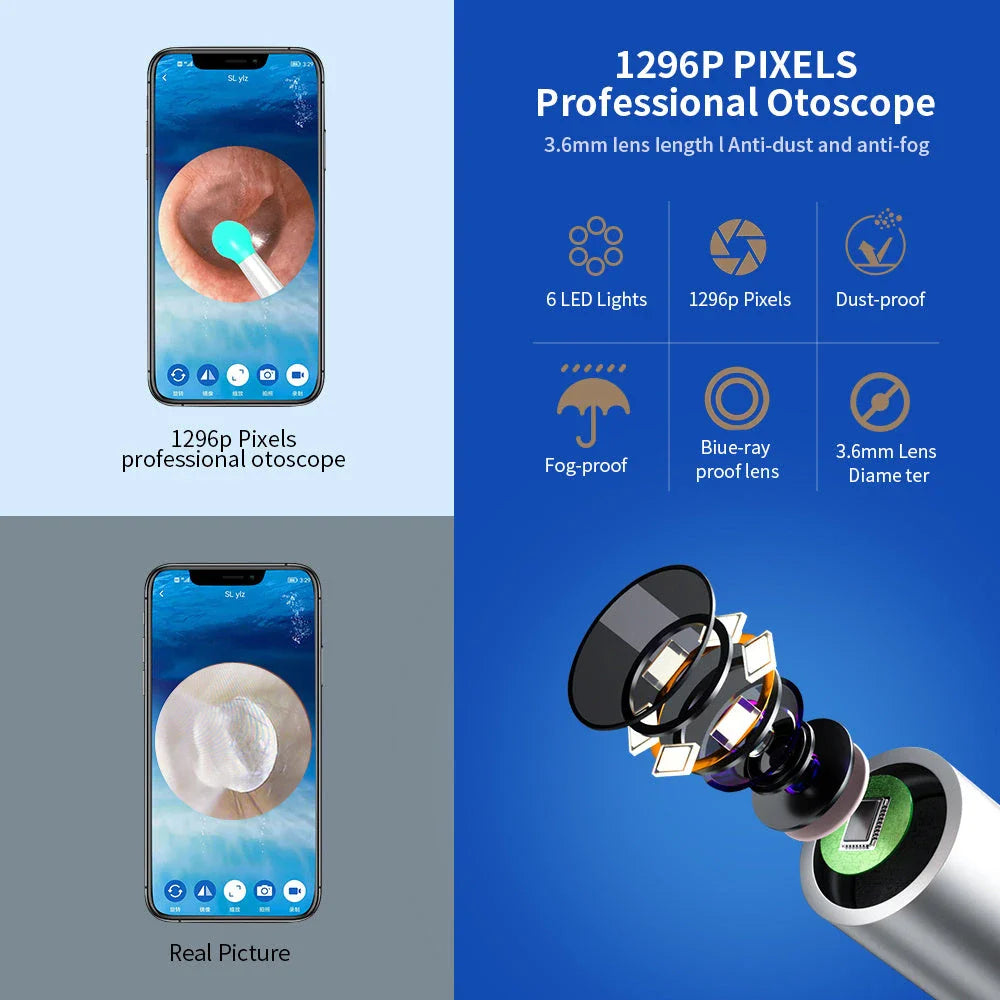 Wireless otoscope with 360-degree HD camera and LED light for safe and effective earwax removal