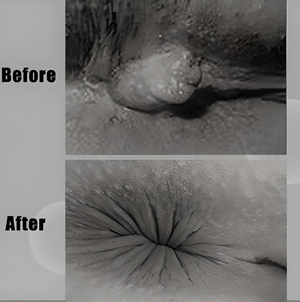 Premium Hemorrhoid Relief Cream - Powerful 2-in-1 formula for fast-acting soothing and healing of hemorrhoid symptoms